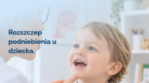 Rozszczep podniebienia u dziecka